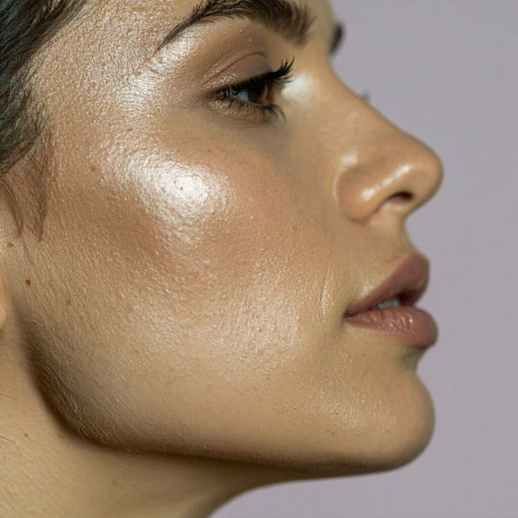 mesoterapia facial en barcelona 3